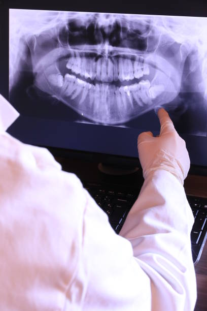 Best Broken or Chipped Tooth Repair in Beacon Hill, WA