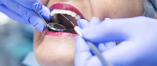 Best Dental Abscess Treatment in Beacon Hill, WA